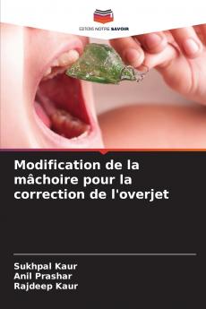 Modification de la mâchoire pour la correction de l'overjet