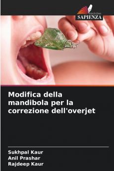 Modifica della mandibola per la correzione dell'overjet