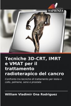 Tecniche 3D-CRT IMRT e VMAT per il trattamento radioterapico del cancro