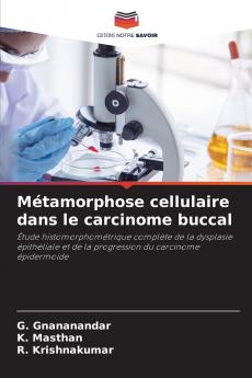 Métamorphose cellulaire dans le carcinome buccal