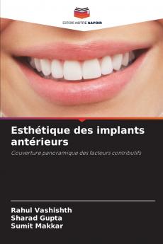 Esthétique des implants antérieurs