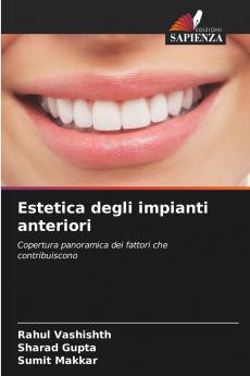 Estetica degli impianti anteriori