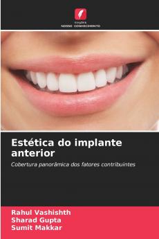 Estética do implante anterior