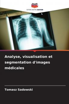 Analyse visualisation et segmentation d'images médicales