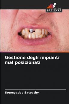 Gestione degli impianti mal posizionati