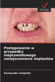 Postępowanie w przypadku nieprawidłowego umiejscowienia implantów
