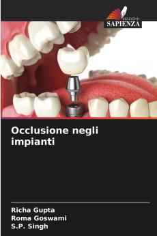 Occlusione negli impianti