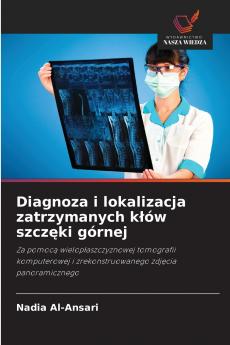 Diagnoza i lokalizacja zatrzymanych kłów szczęki górnej