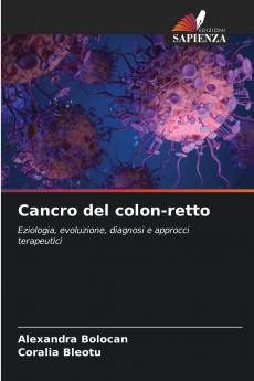 Cancro del colon-retto