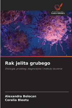 Rak jelita grubego