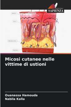 Micosi cutanee nelle vittime di ustioni