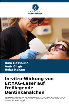 In-vitro-Wirkung von Er