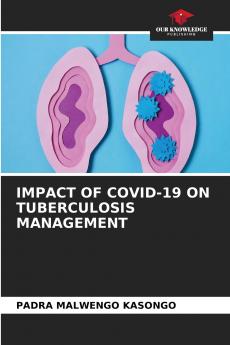 IMPACT OF COVID-19 ON TUBERCULOSIS MANAGEMENT