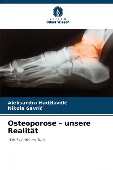 Osteoporose - unsere Realität