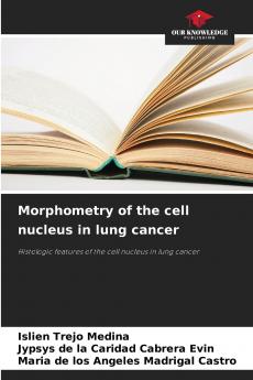Morphometry of the cell nucleus in lung cancer