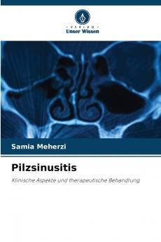 Pilzsinusitis