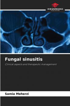 Fungal sinusitis
