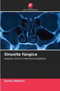 Sinusite fúngica