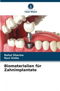 Biomaterialien für Zahnimplantate