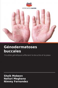 Génodermatoses buccales