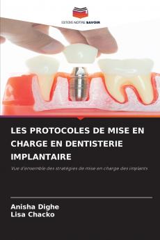 LES PROTOCOLES DE MISE EN CHARGE EN DENTISTERIE IMPLANTAIRE