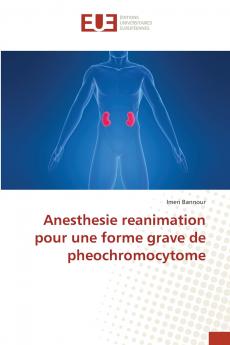 Anesthesie reanimation pour une forme grave de pheochromocytome