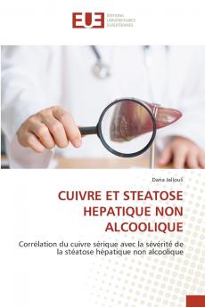 CUIVRE ET STEATOSE HEPATIQUE NON ALCOOLIQUE