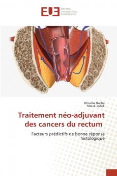 Traitement néo-adjuvant des cancers du rectum