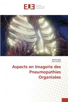 Aspects en Imagerie des Pneumopathies Organisées