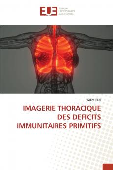IMAGERIE THORACIQUE DES DEFICITS IMMUNITAIRES PRIMITIFS