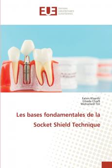 Les bases fondamentales de la Socket Shield Technique