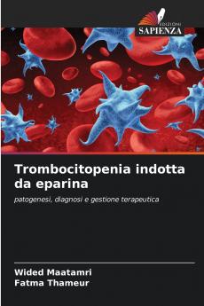 Trombocitopenia indotta da eparina