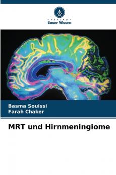 MRT und Hirnmeningiome