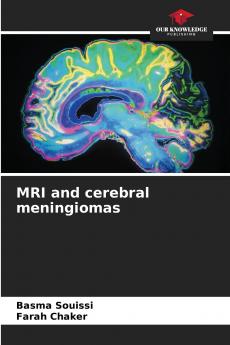 MRI and cerebral meningiomas