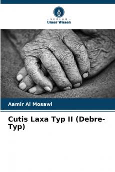 Cutis Laxa Typ II (Debre-Typ)