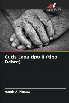Cutis Laxa tipo II (tipo Debre)