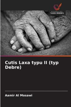 Cutis Laxa typu II (typ Debre)