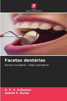 Facetas dentárias