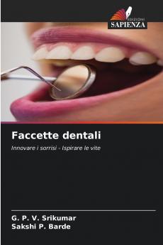 Faccette dentali