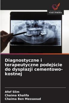 Diagnostyczne i terapeutyczne podejście do dysplazji cementowo-kostnej