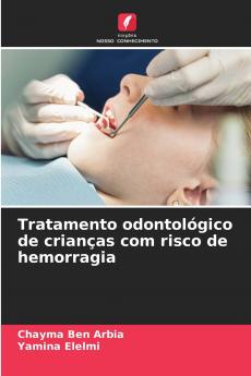 Tratamento odontológico de crianças com risco de hemorragia