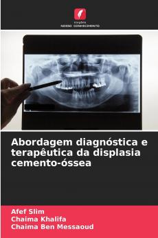 Abordagem diagnóstica e terapêutica da displasia cemento-óssea