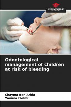 Odontological management of children at risk of bleeding