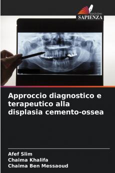Approccio diagnostico e terapeutico alla displasia cemento-ossea