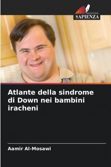 Atlante della sindrome di Down nei bambini iracheni