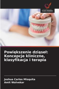 Powiększenie dziąseł