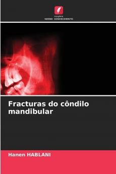 Fracturas do côndilo mandibular