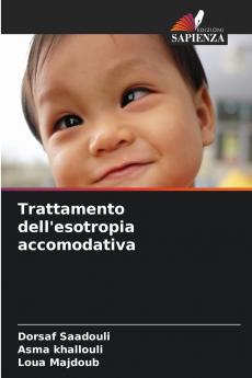 Trattamento dell'esotropia accomodativa