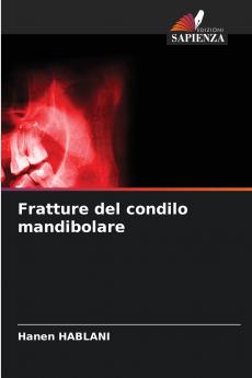 Fratture del condilo mandibolare