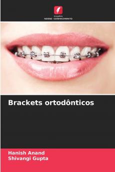Brackets ortodônticos
